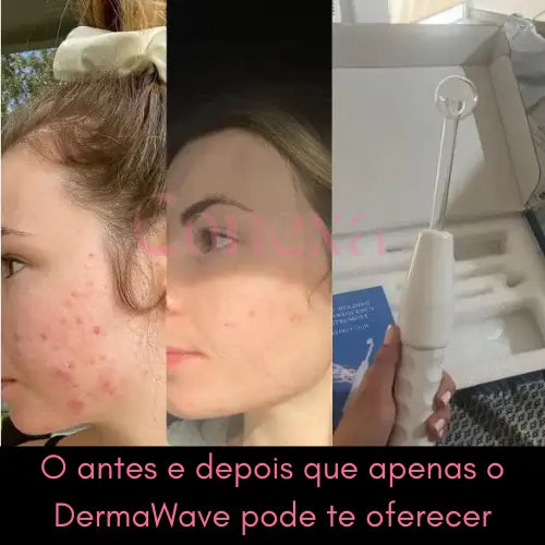 DermaWave: Tecnologia de Alta Frequência para Pele e Cabelo 4 em 1